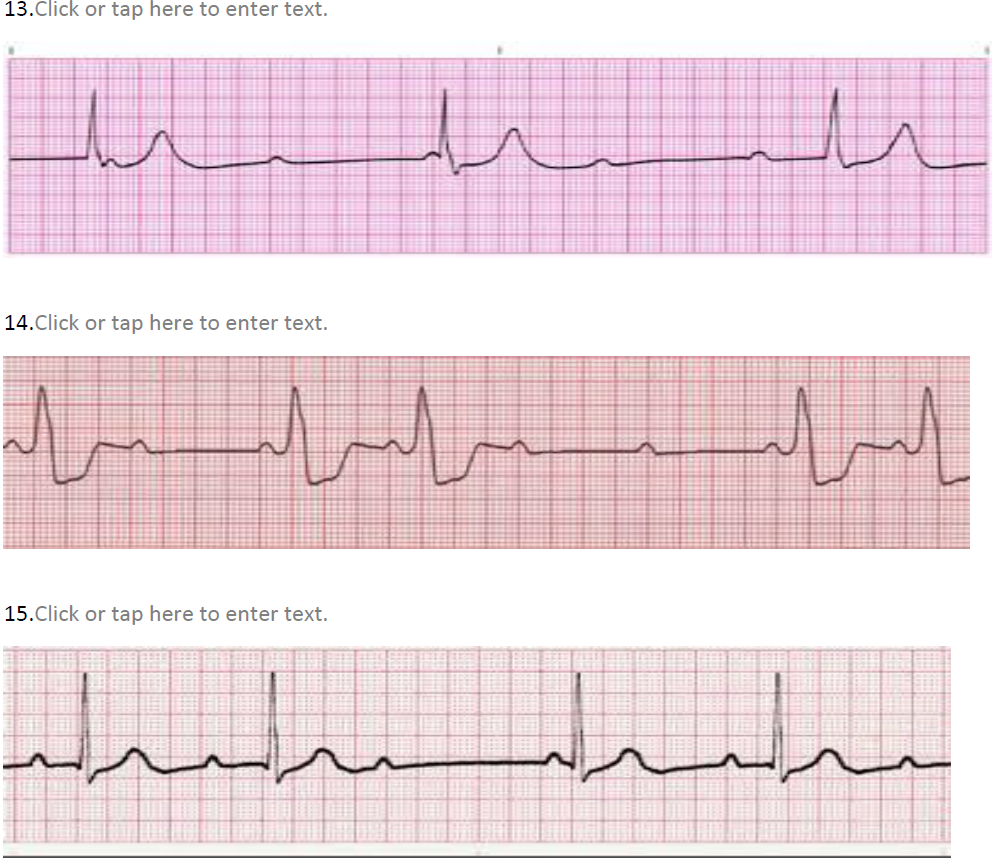 Solved Determine the types of Blocks in the rhythm | Chegg.com