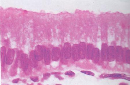 Solved What type of cells are shown? Columnar epithelium, | Chegg.com