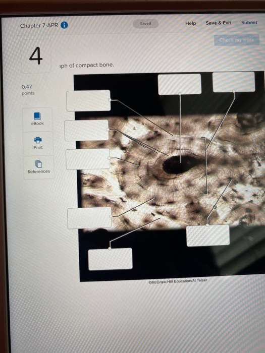 34 Label The Photomicrograph Of Compact Bone. - Labels Design Ideas 2020