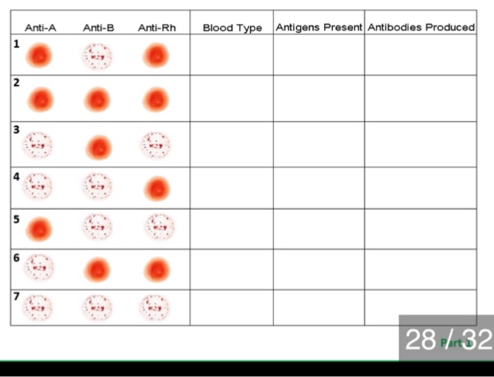 Blood Typing Anatomy And Physiology II, 59% OFF