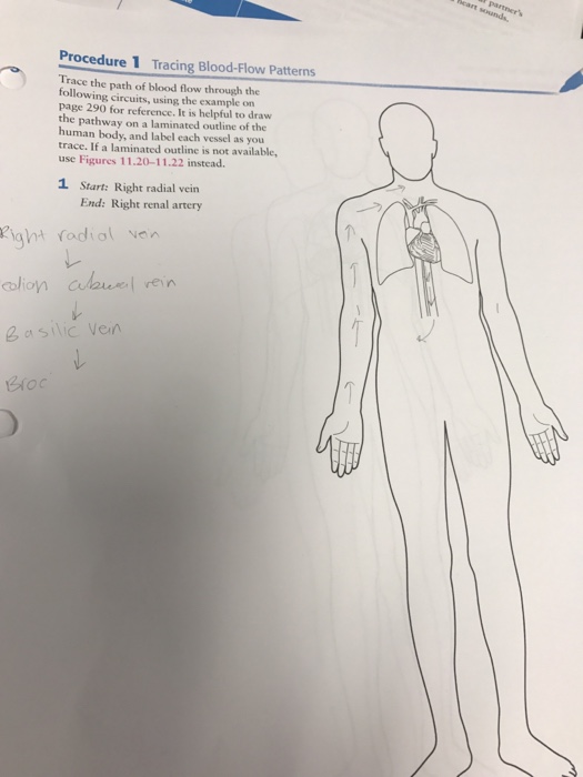 Solved Procedure 1 Tracing BloodFlow Patterns Trace the