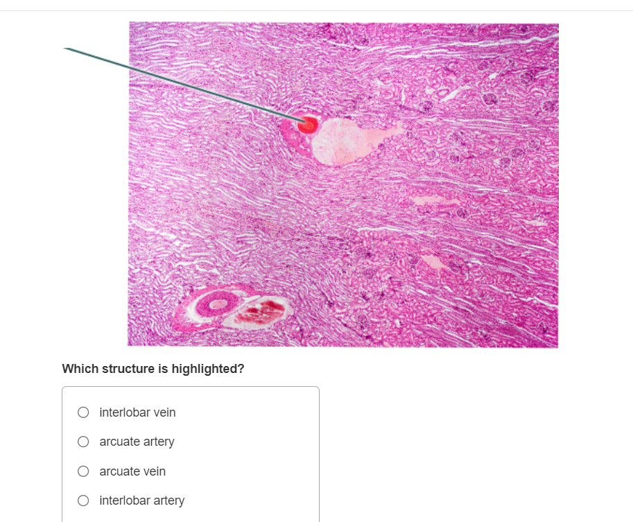 Which structure is highlighted?
interlobar vein
arcuate artery
arcuate vein
interlobar artery