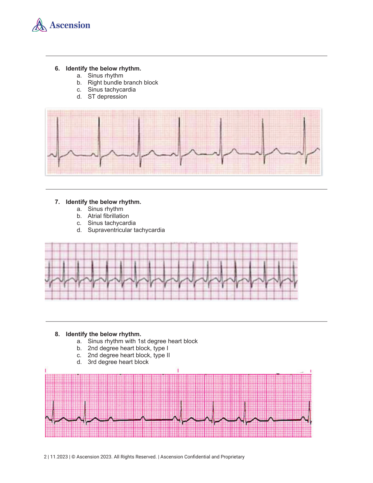 Solved 7. ﻿Identify the below rhythm.a. ﻿Sinus rhythmb. | Chegg.com