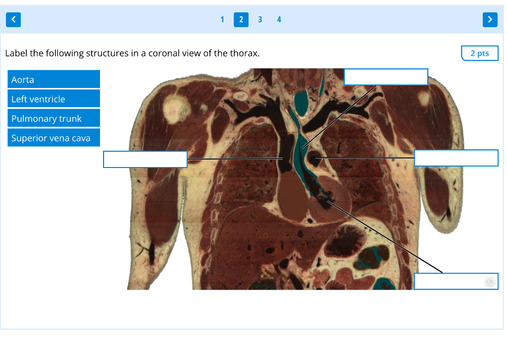 Label the following structures in a coronal view of the thorax.