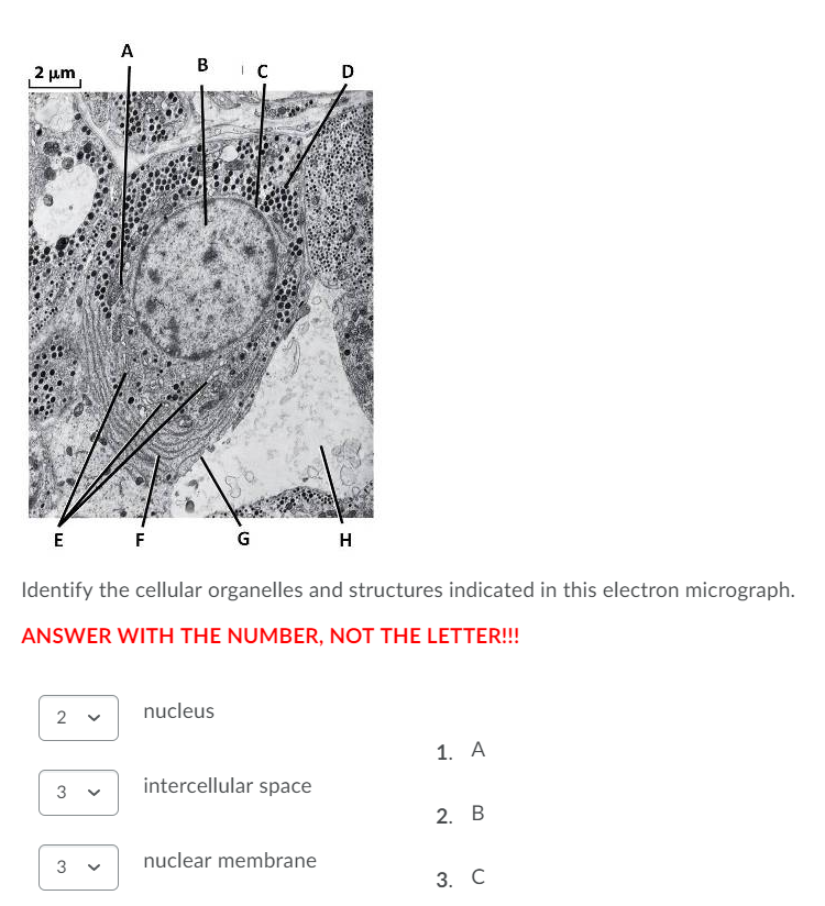 Solved The mitochondiral matrix targetting motif is... | Chegg.com