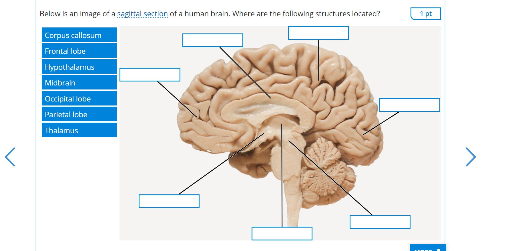 sagittal view of the human brain labeled