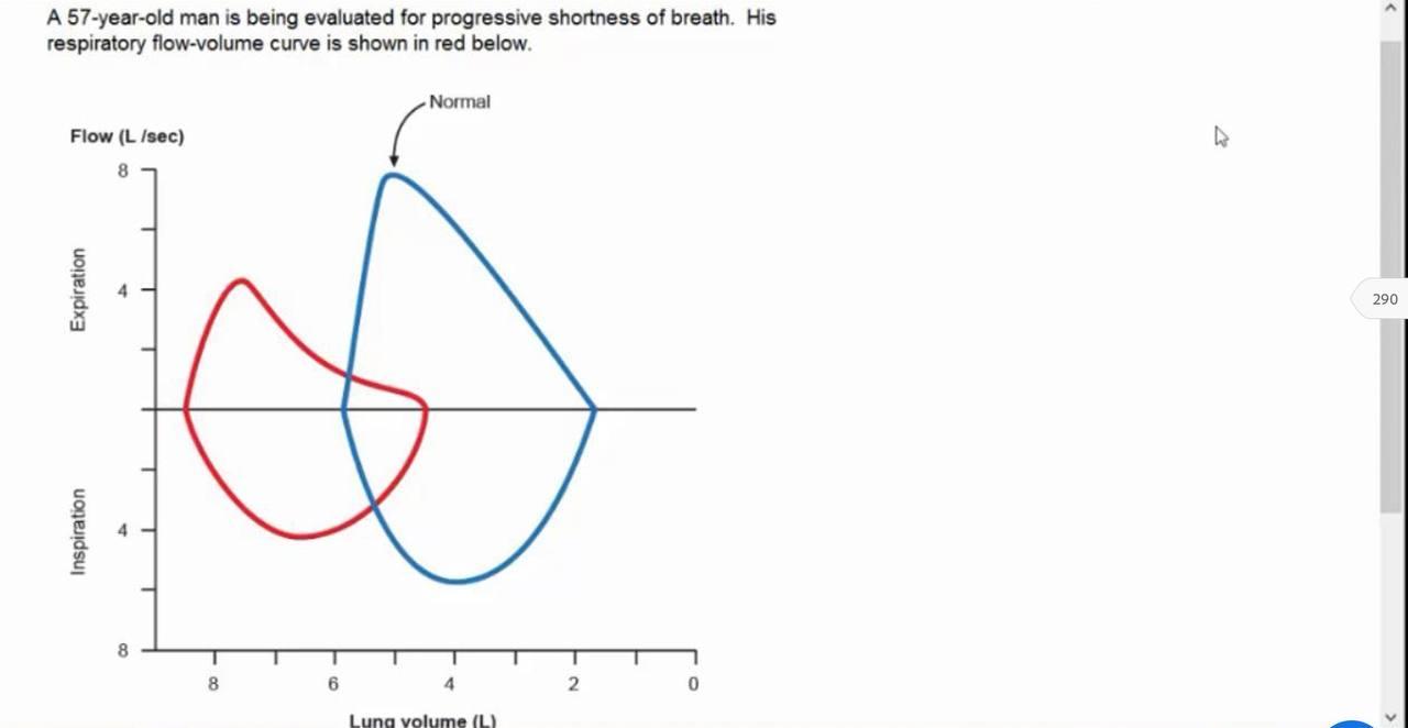 A 57-year-old Man Is Being Evaluated For Progressive 