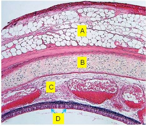 Solved A-C. Identify the tissues (be specific) D. State | Chegg.com