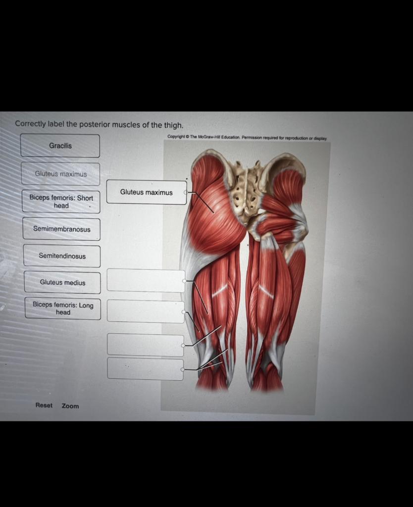 Solved Correctly label the posterior muscles of the thigh.