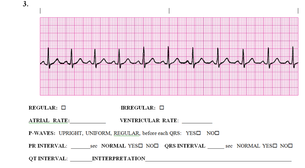 Solved 3. REGULAR: ATRIAL RATE: P-WAVES: UPRIGHT, UNIFORM, | Chegg.com
