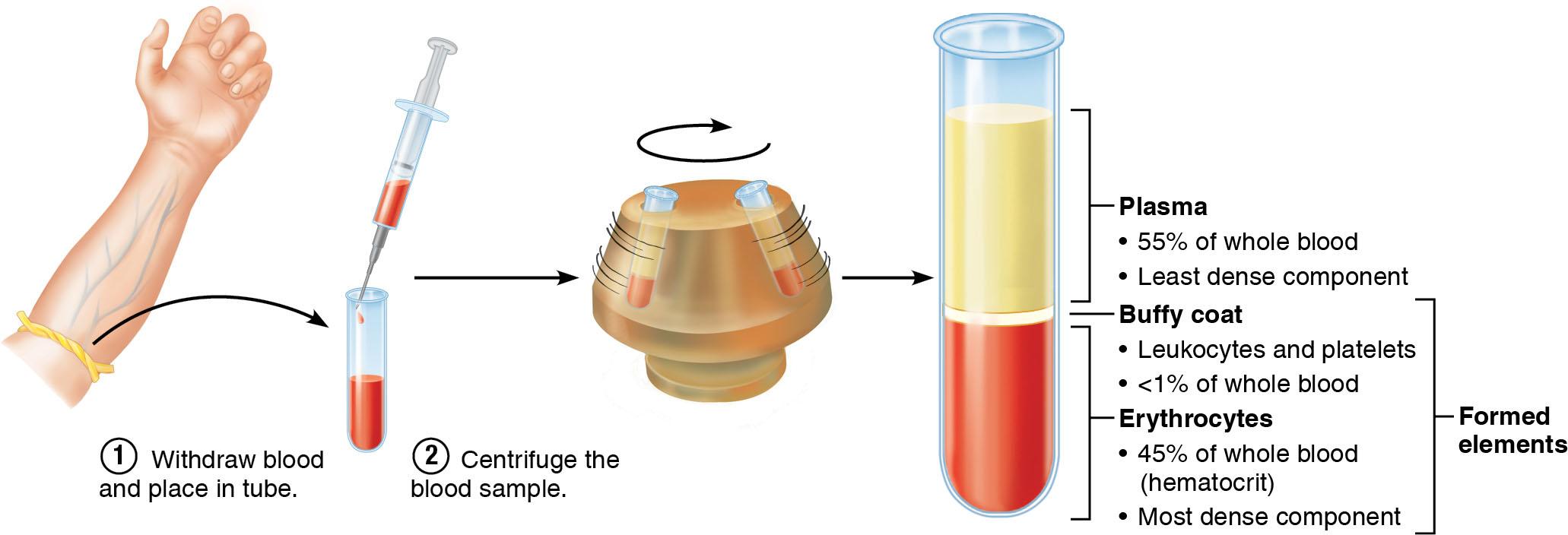Solved 1. Why is blood divided into three layers (plasma,