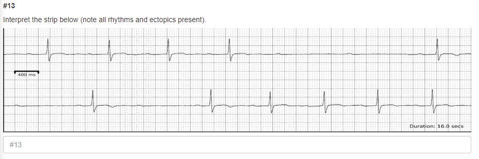 Solved Interpret The Strip Below (note All Rhythms And | Chegg.com