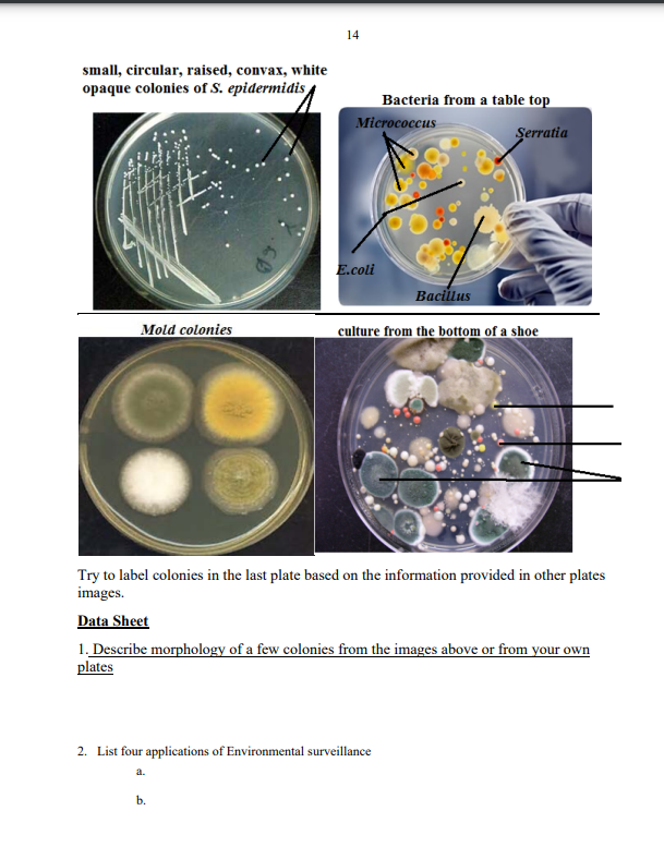 small, circular, raised, convax, white onane colonies of \( \mathrm{S} \) enidermidis 4
Try to label colonies in the last pla