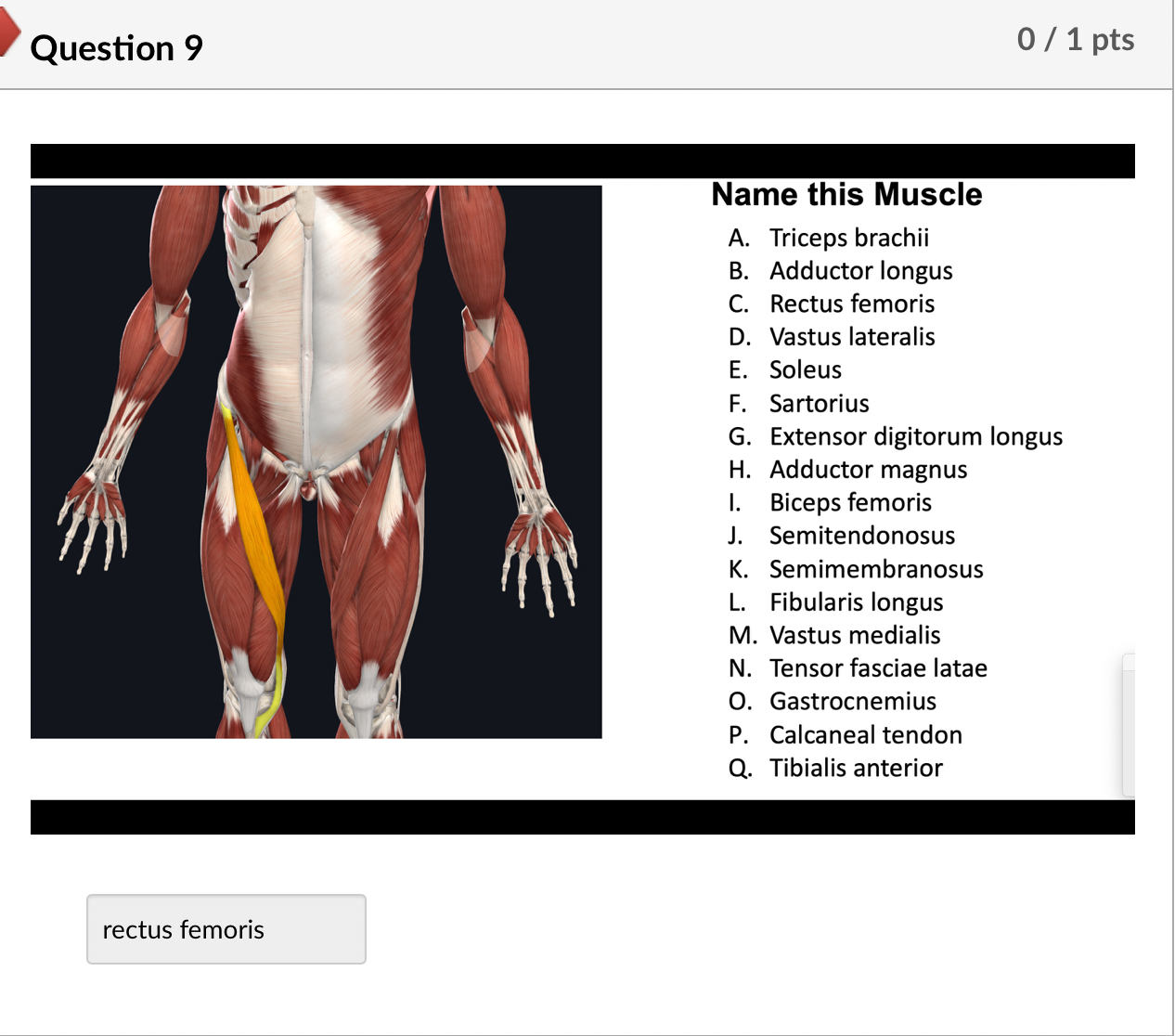 Triceps Brachii Palpation Muscle Anatomy Master Class 