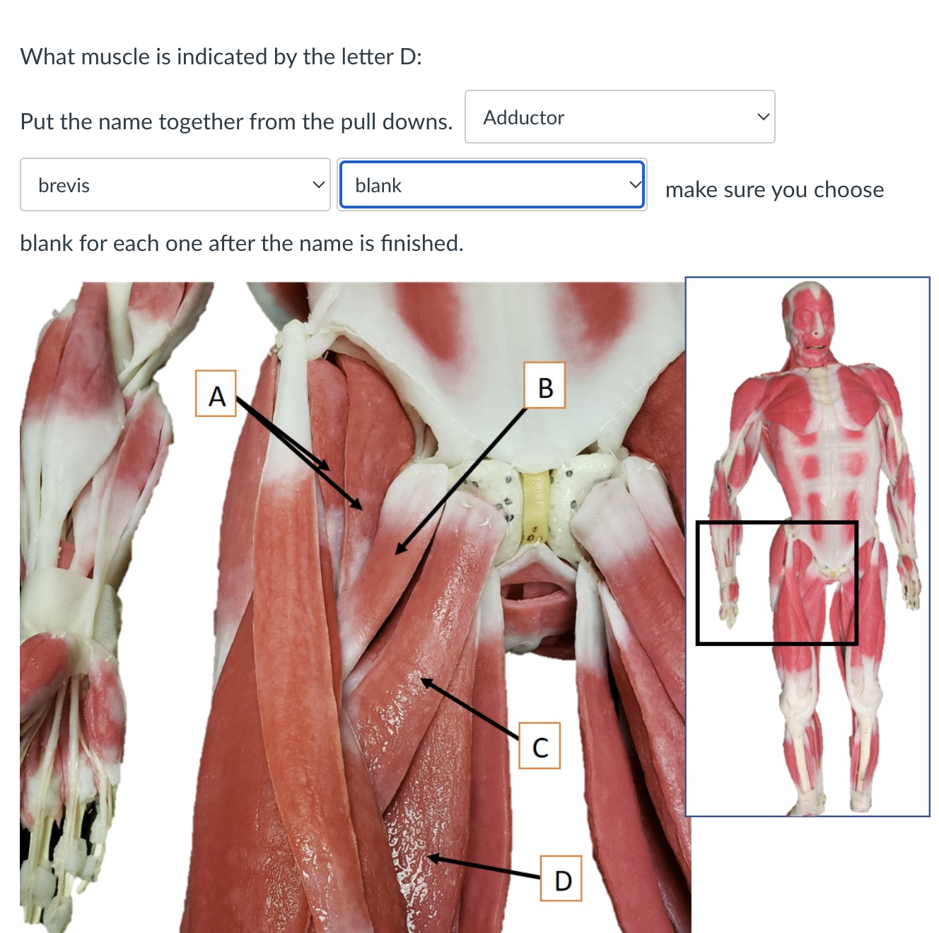 Solved What muscle is indicated by the letter D: Put the | Chegg.com
