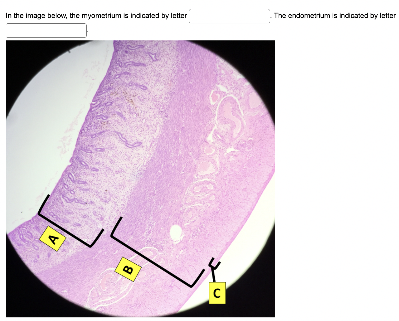 Solved In the image below, the myometrium is indicated by | Chegg.com