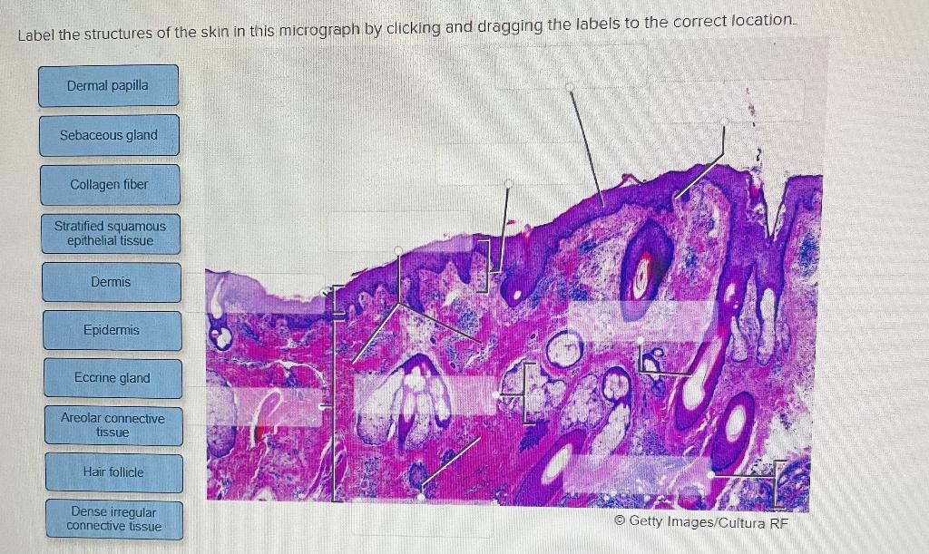 Label the structures of the skin in this micrograph by clicking and dragging the labels to the correct location.