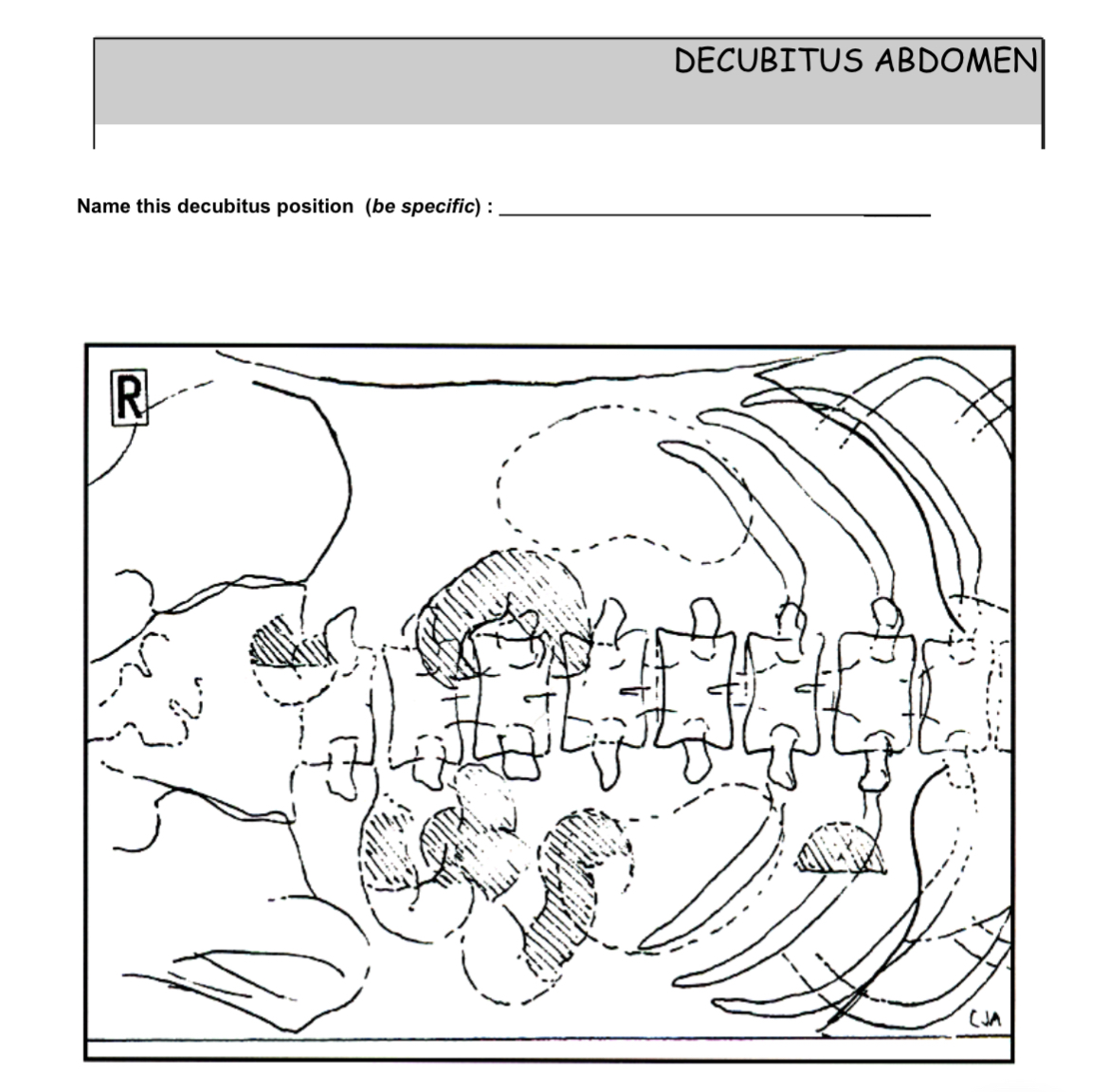 Solved Decubitus abdomen - ﻿name the decub (be specific); | Chegg.com