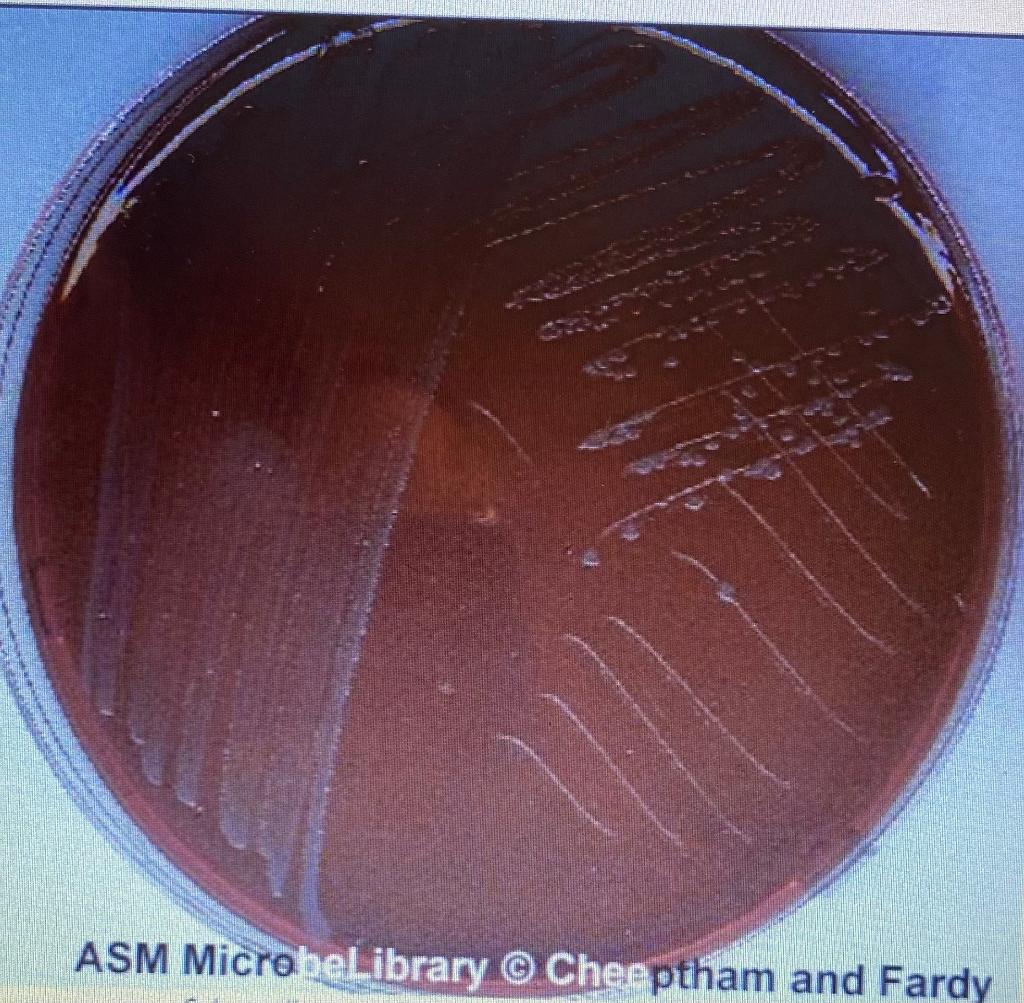 Solved Based upon the image above, S. enteriditis A. | Chegg.com