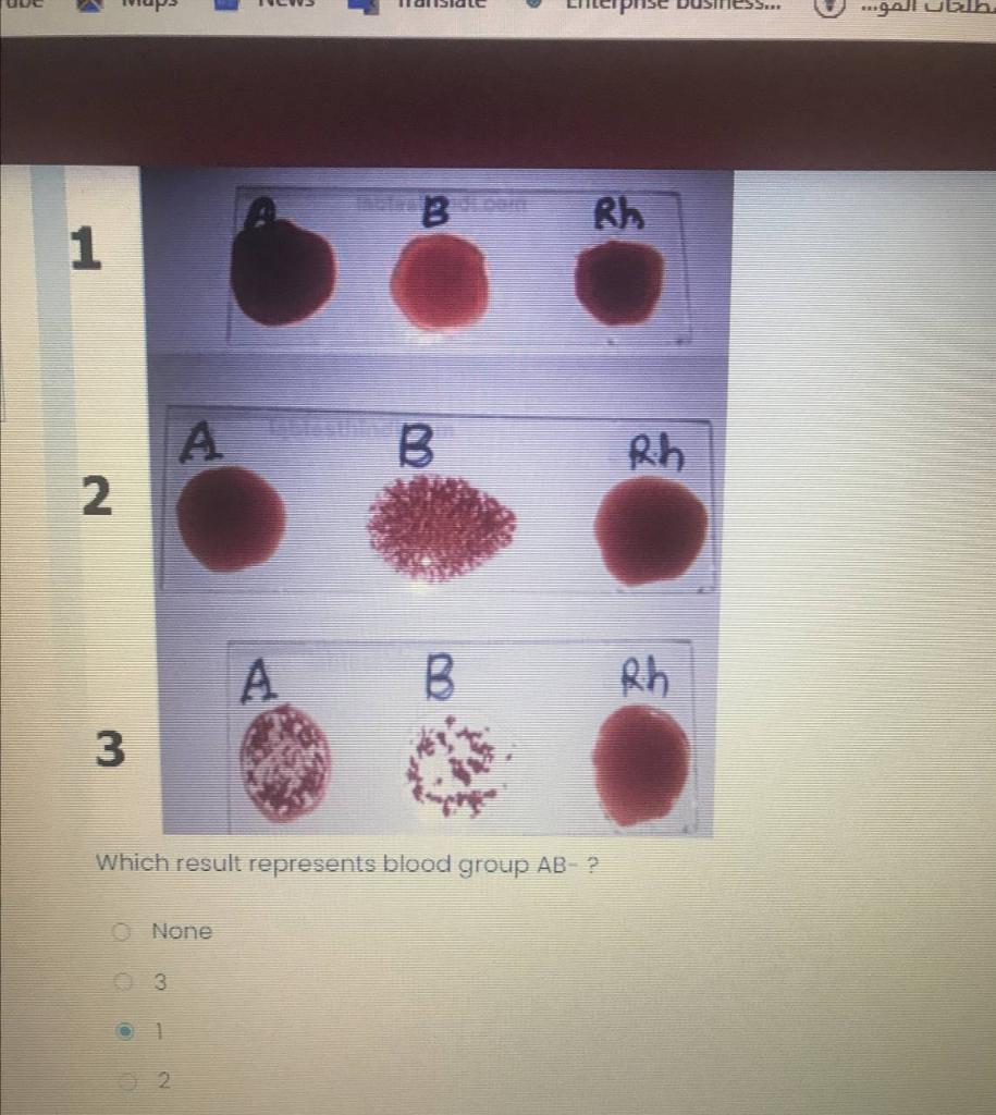 Solved جانا الهو،هه Rh 1 A B Rih 2 B. Rh 3 Which Result | Chegg.com