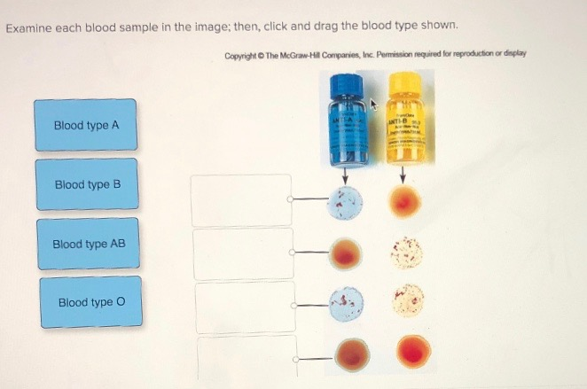 Solved Examine Each Blood Sample In The Image; Then, Click | Chegg.com