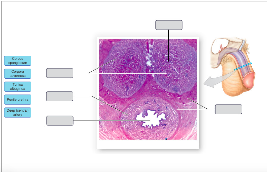 Solved Corpus spongiosum Corpora cavernosa Tunica albuginea