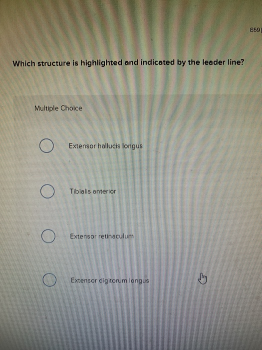 Solved: Left Leg 859 Which Structure Is Highlighted And In... | Chegg.com