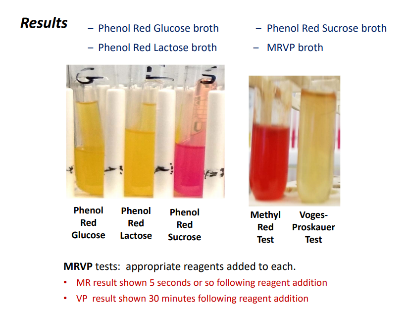 Solved Biochemical Tests on Gramnegative Isolate (20