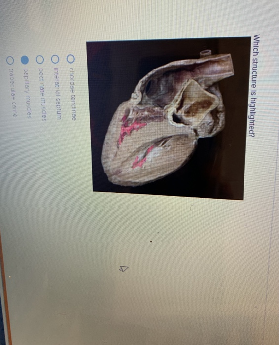 Solved Which structure Is highlighted? O chordae tendinae