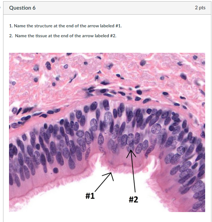 Solved Question 6 2 pts 1. Name the structure at the end of | Chegg.com