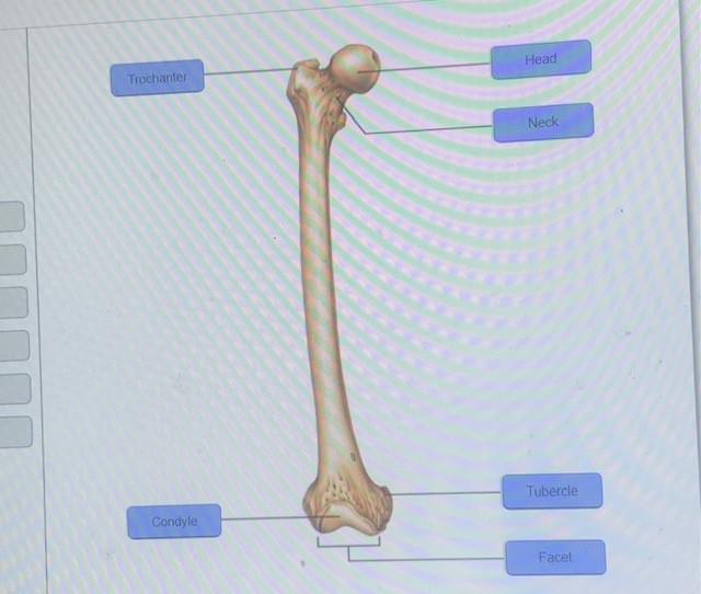 Solved Art-labeling Activity: Bone Markings (Femur) Part | Chegg.com