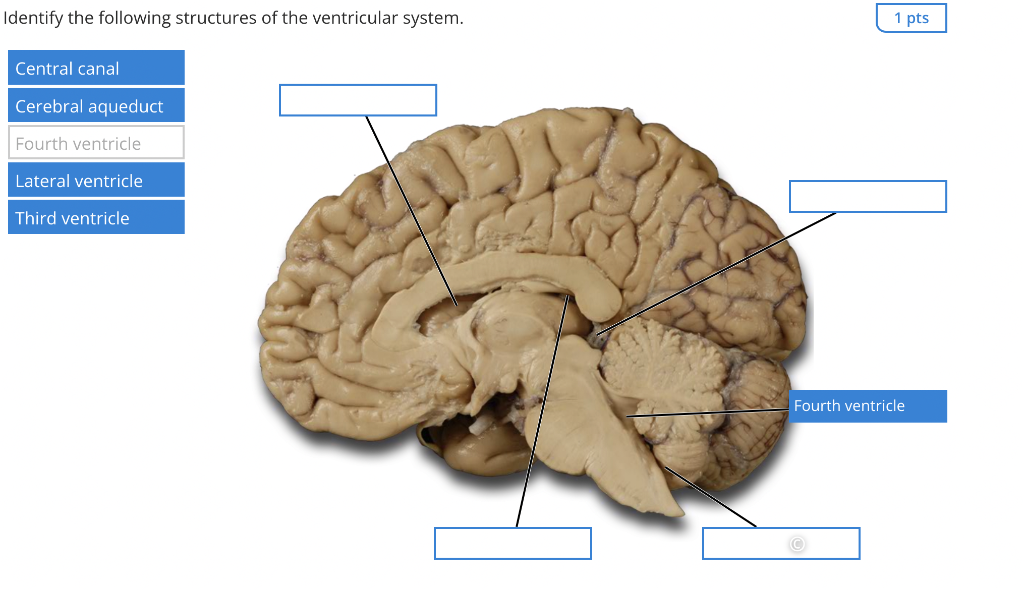 Identify the following structures of the ventricular system.