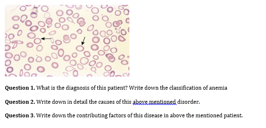 Question 1. What is the diagnosis of this patient? Write down the classification of anemia Question 2. Write down in detail t