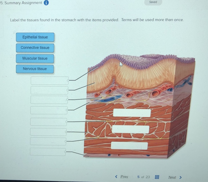 Solved Label the tissues found in the stomach with the items | Chegg.com