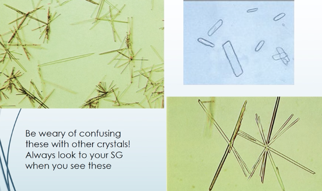 radiographic dye crystals in urine