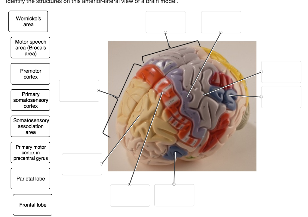 Solved Identify the structures on this midsagittal view of a | Chegg.com