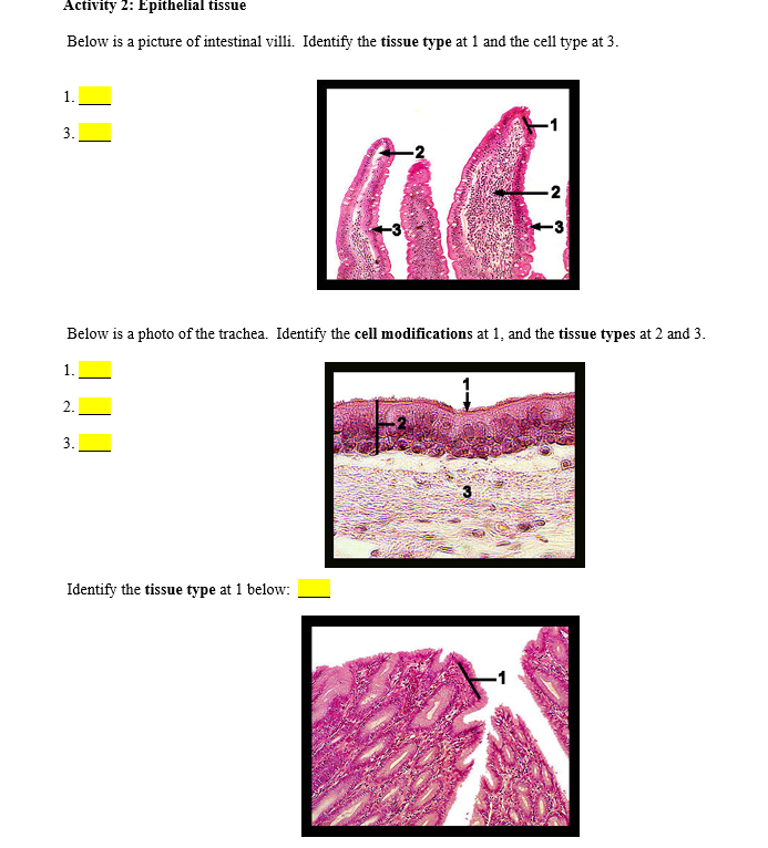 Solved Activity 2: Epithelial Tissue Below Is A Picture Of | Chegg.com