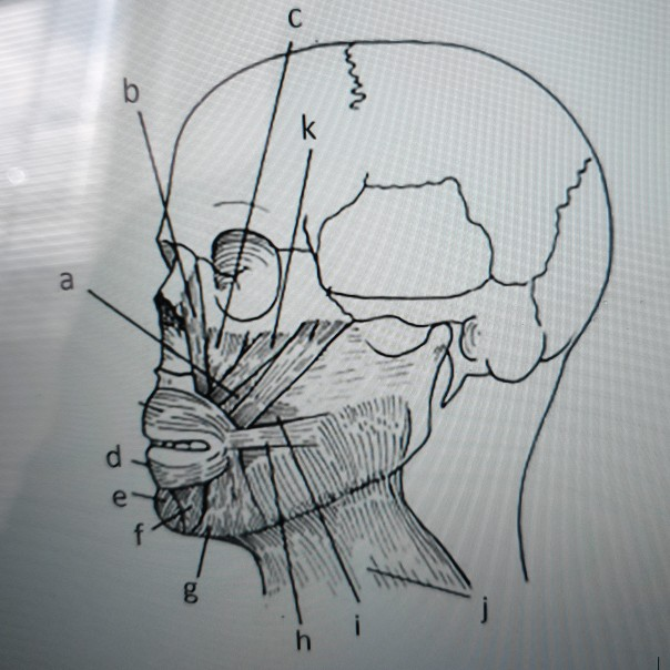 Solved 1. _____ platysma 2. _____ mentalis 3. _____ | Chegg.com