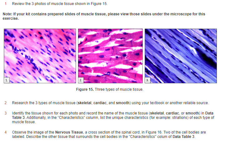 Solved Data Table 3 Microscopic Examination Of Muscle An