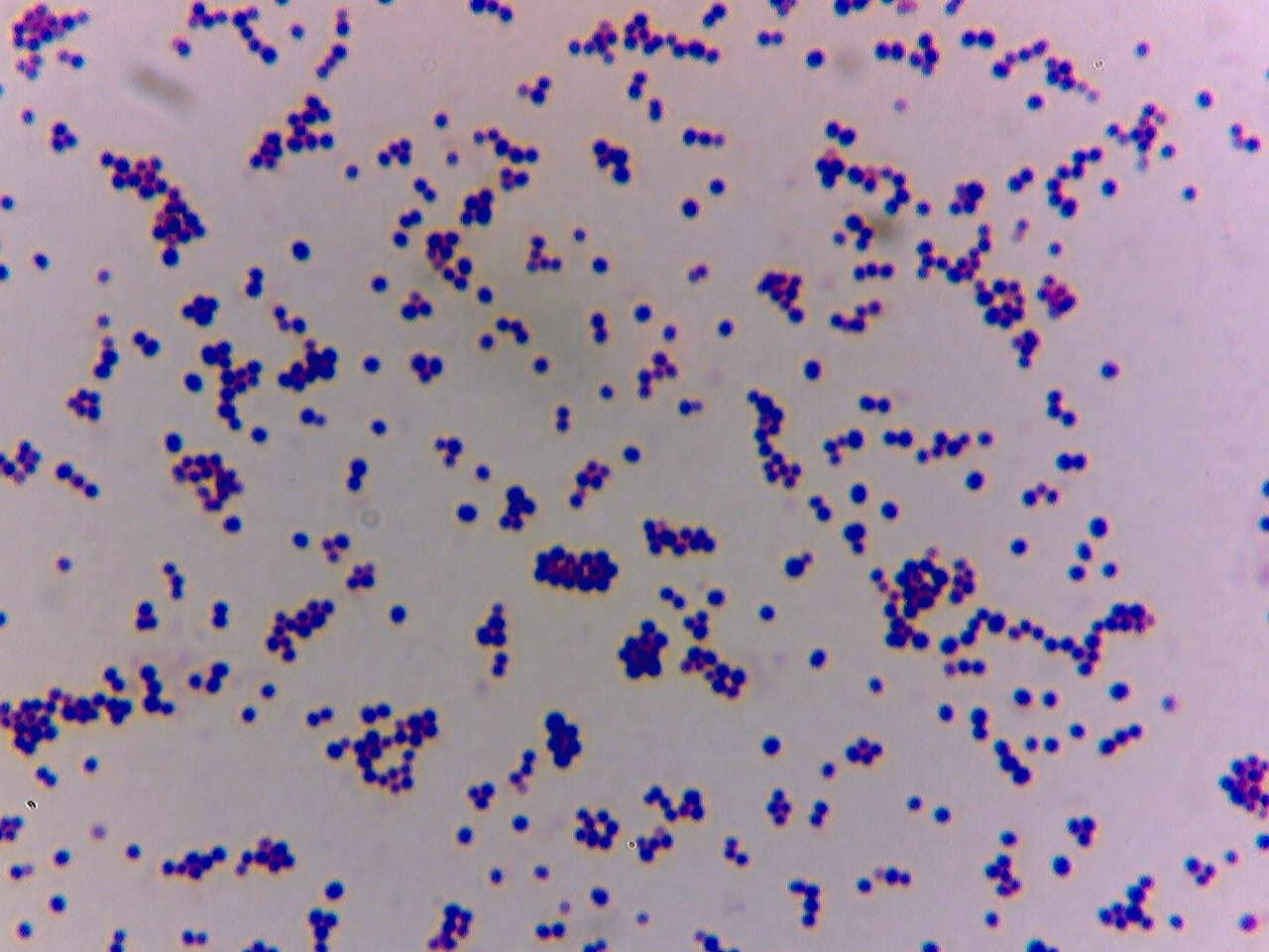 Solved micro.... 1)How would the following Gram stain be | Chegg.com