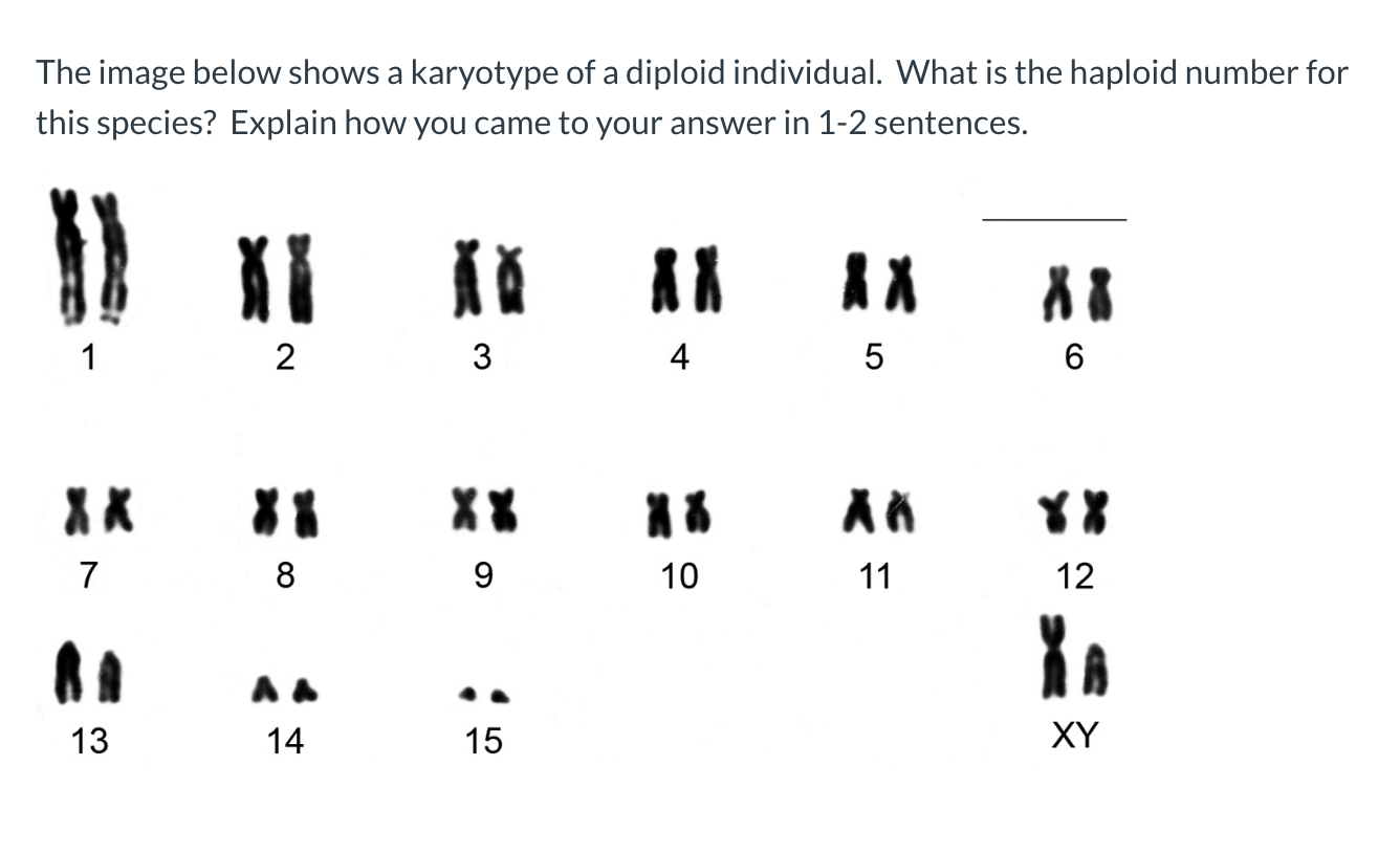 Solved The image below shows a karyotype of a diploid | Chegg.com