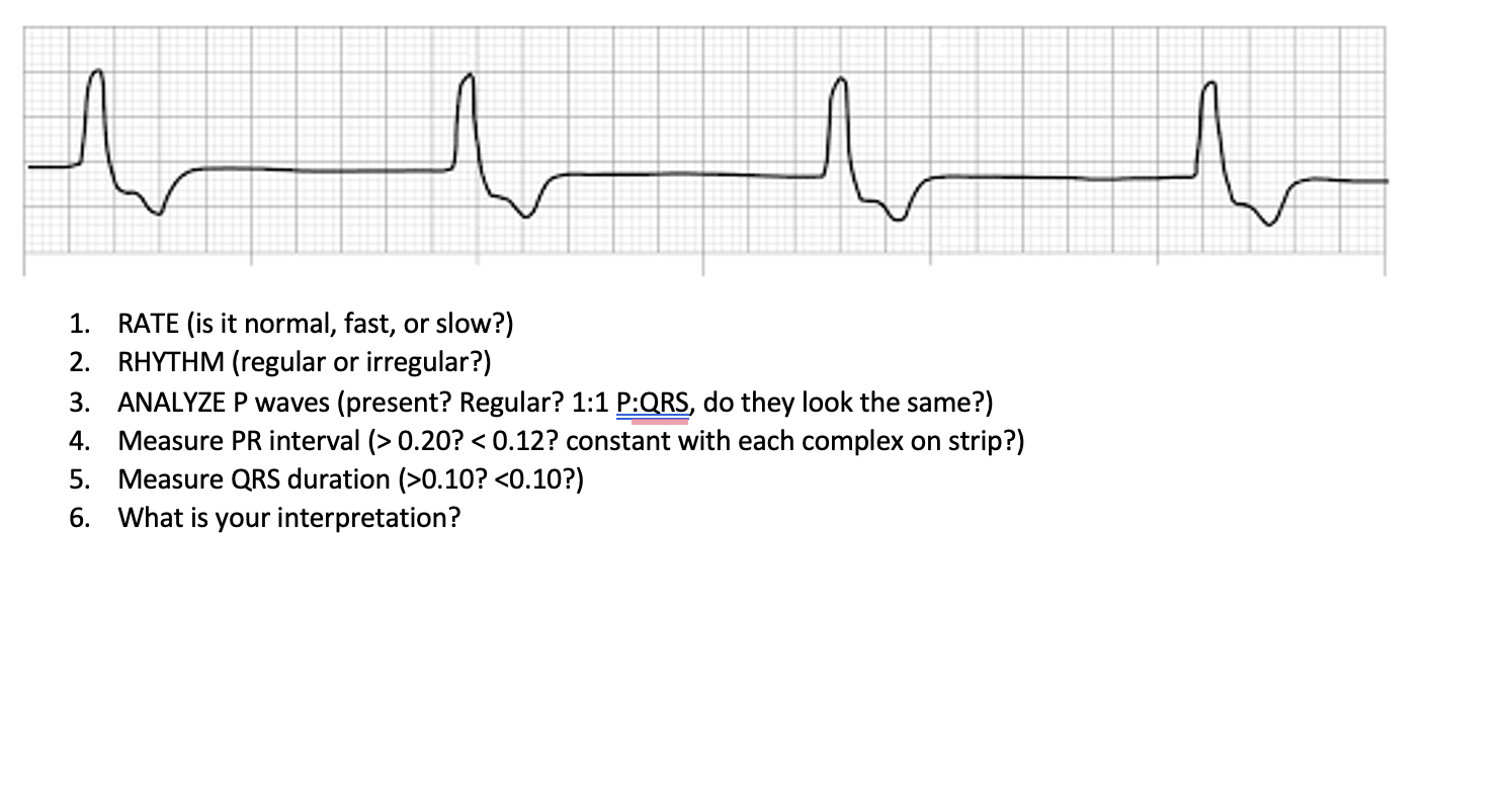 Solved 1. RATE (is it normal, fast, or slow?) 2. RHYTHM | Chegg.com