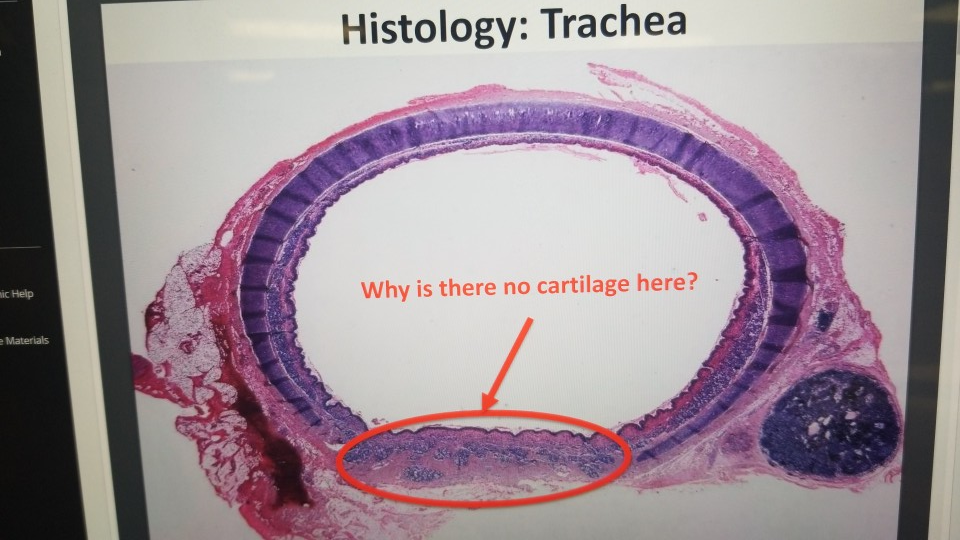 Solved: Histology: Trachea Why Is There No Cartilage Here? 1ae