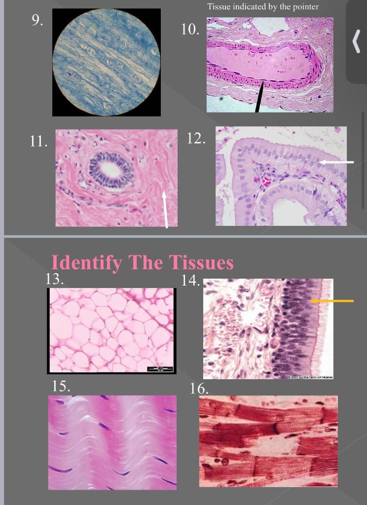 Solved Identify The Tissues 2. 3. Identify The Tissues 16. | Chegg.com