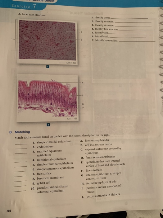 Stratified Epithelial Tissue Labeling Exercise