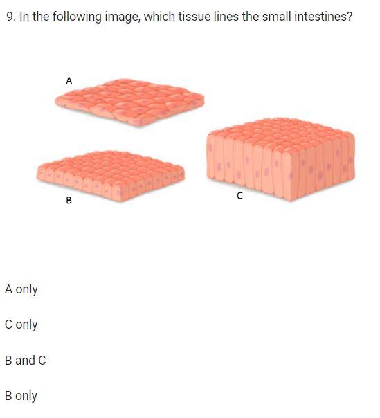 Solved 9. In the following image, which tissue lines the | Chegg.com