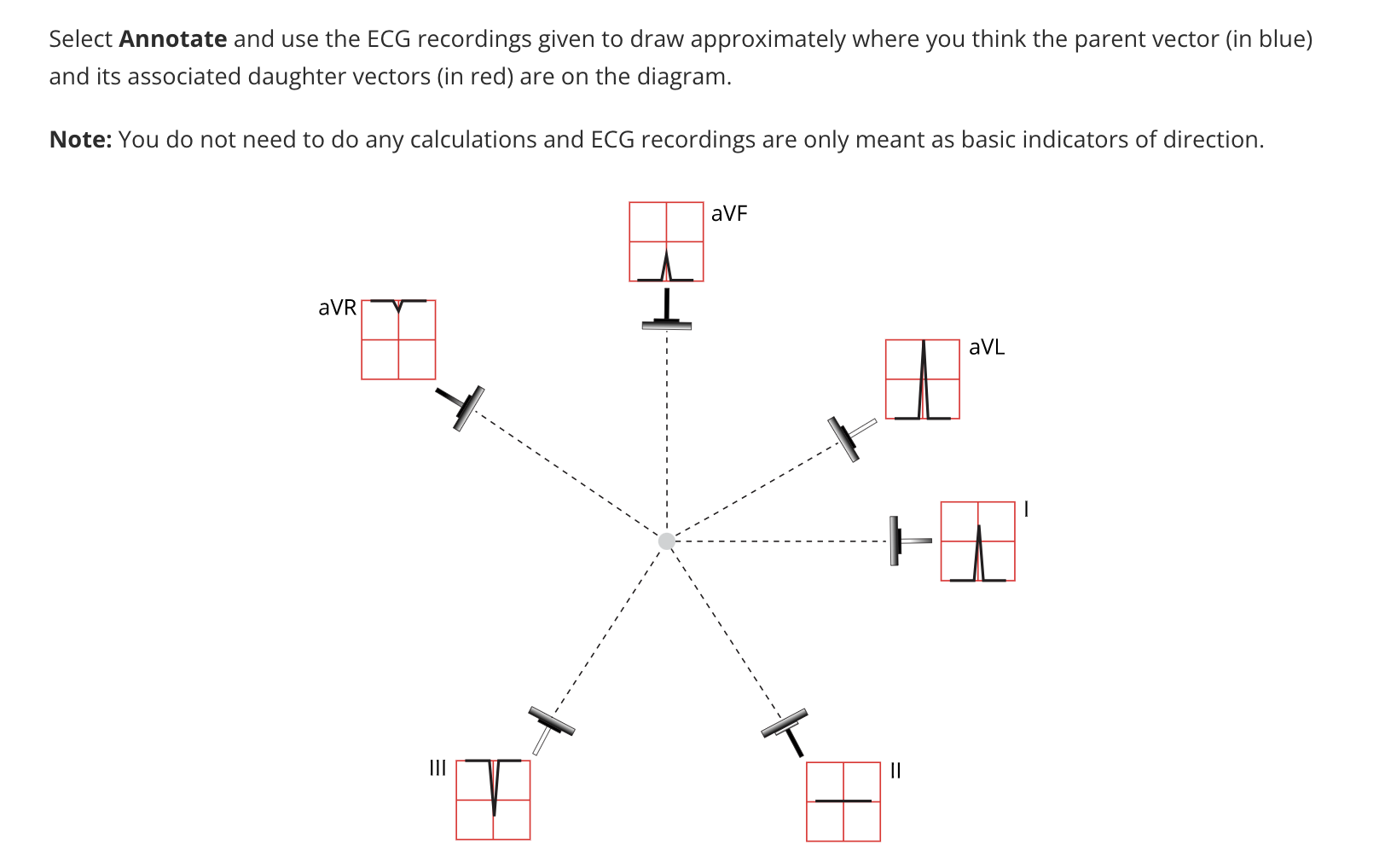 solved-select-annotate-and-use-the-ecg-recordings-given-to-chegg