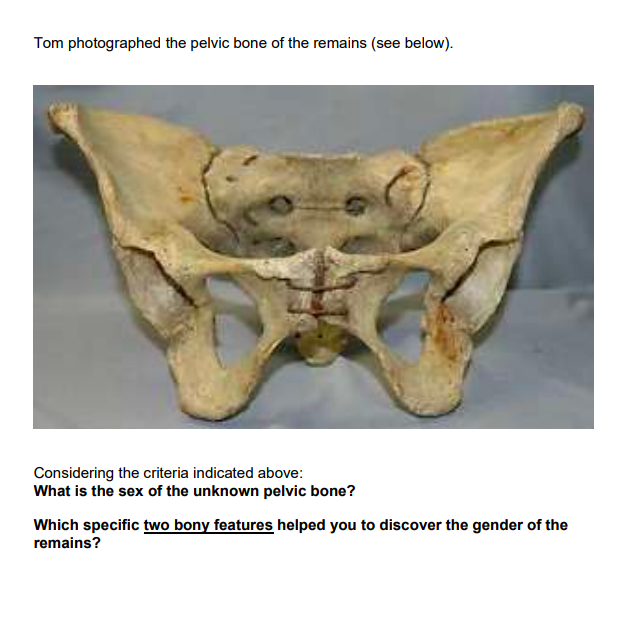 AFP Fact Check 🔎 on X: ⚠️ Anti-LGBTQ posts claim archaeologists can  determine whether a person is male or female purely from their pelvic bone.  Experts say it is difficult to determine