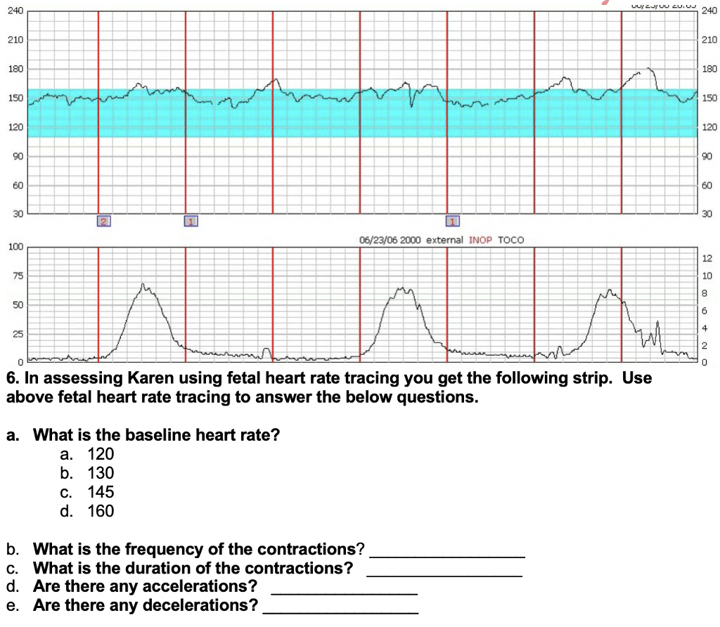 How To Read Fetal Heart Rate Monitoring Strips - BEST GAMES WALKTHROUGH