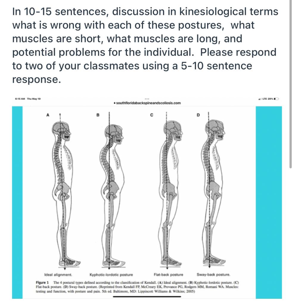 Muscles: Testing and Testing and Function with Posture and Pain